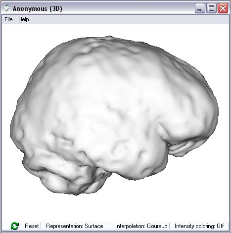 3D result of brain extraction.